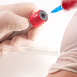 Análisis rápido de Colesterol y Azúcar