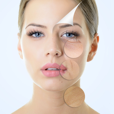 Anàlisi facial