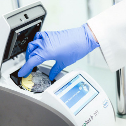 Análisis perfil lipídico