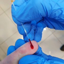 Análisis rápido de Colesterol y Azúcar