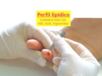 Análisis perfil lipídico