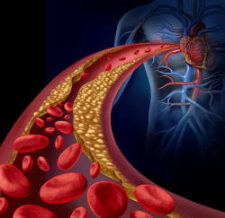 Determinación del riesgo cardiovascular