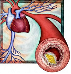 Vitamina D colesterol