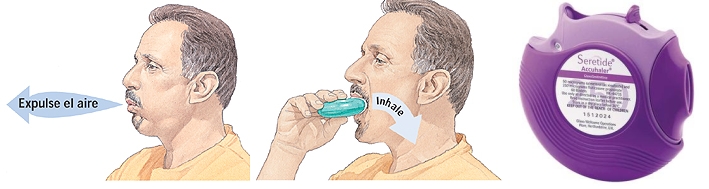 Dispositivos para inhalación: técnica correcta de inhalación