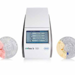 Análisis hemoglobina glicada 