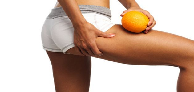 Celulitis, nos reencontramos de nuevo