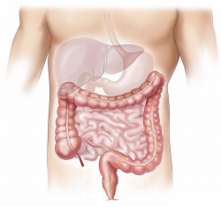 Programa de detección de cáncer de colon 