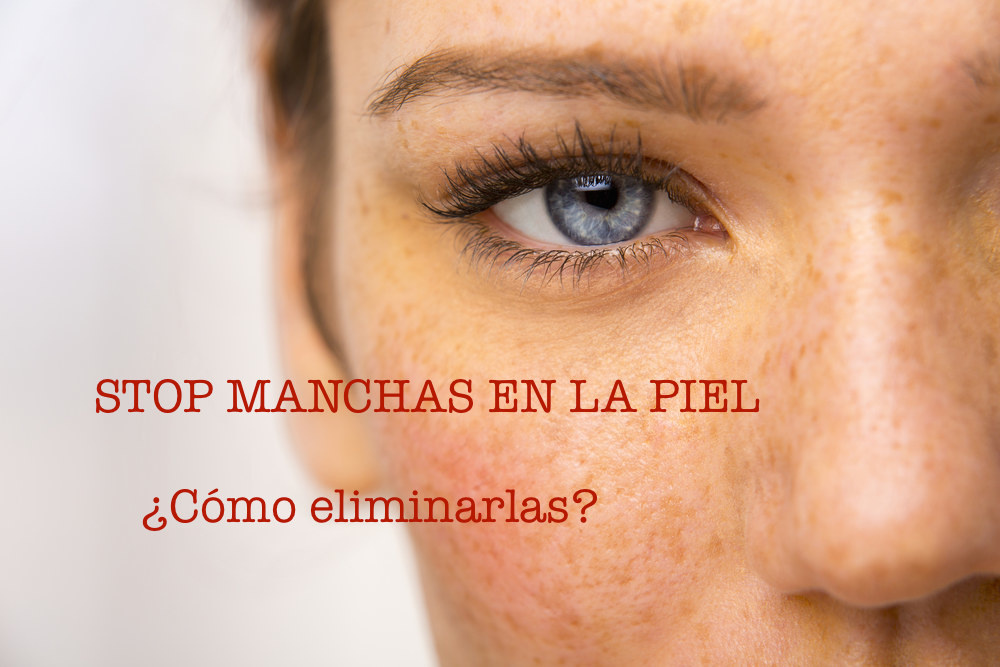 ¿A quién no le preocupan las manchas con la llegada del buen tiempo?