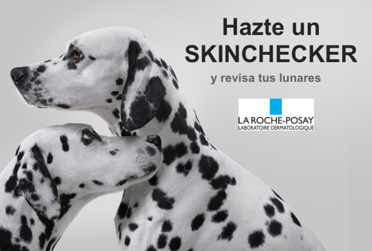 ¡Házte un SkinChecker y revisa tus lunares! Te lo explicamos en qué consiste