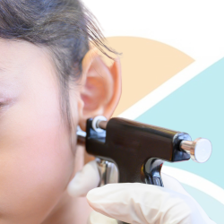 Perforació del lòbul de l’orella