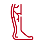 Medida de Insuficiencia Venosa