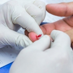 Anàlisi ràpid de colesterol i glucosa