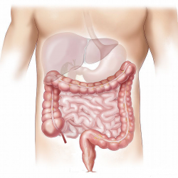 Programa de detecció del càncer de colon 